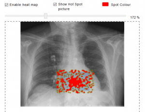 Hot Spot Heat Map in eSystem exam software